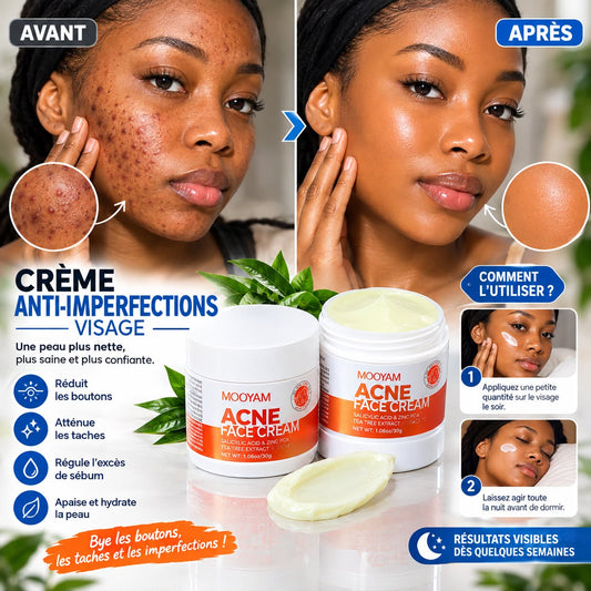 MOOYAM Acne Face Cream – Crème visage peaux à imperfections 30 g